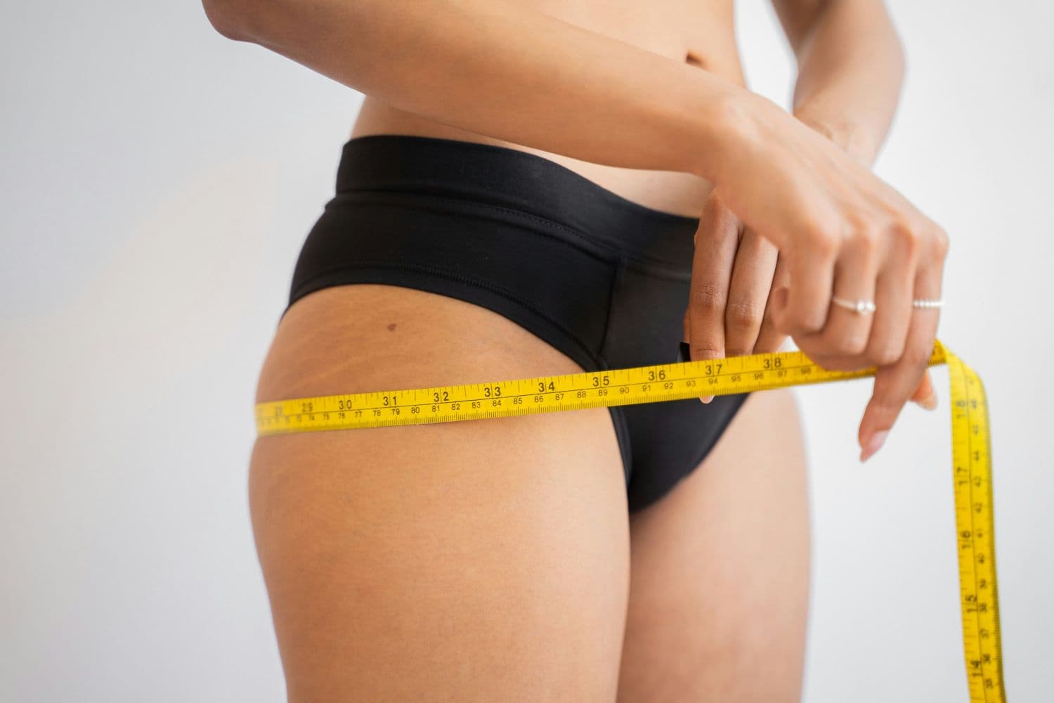 Ätiologie der Cellulite. Warum entsteht Cellulite?
