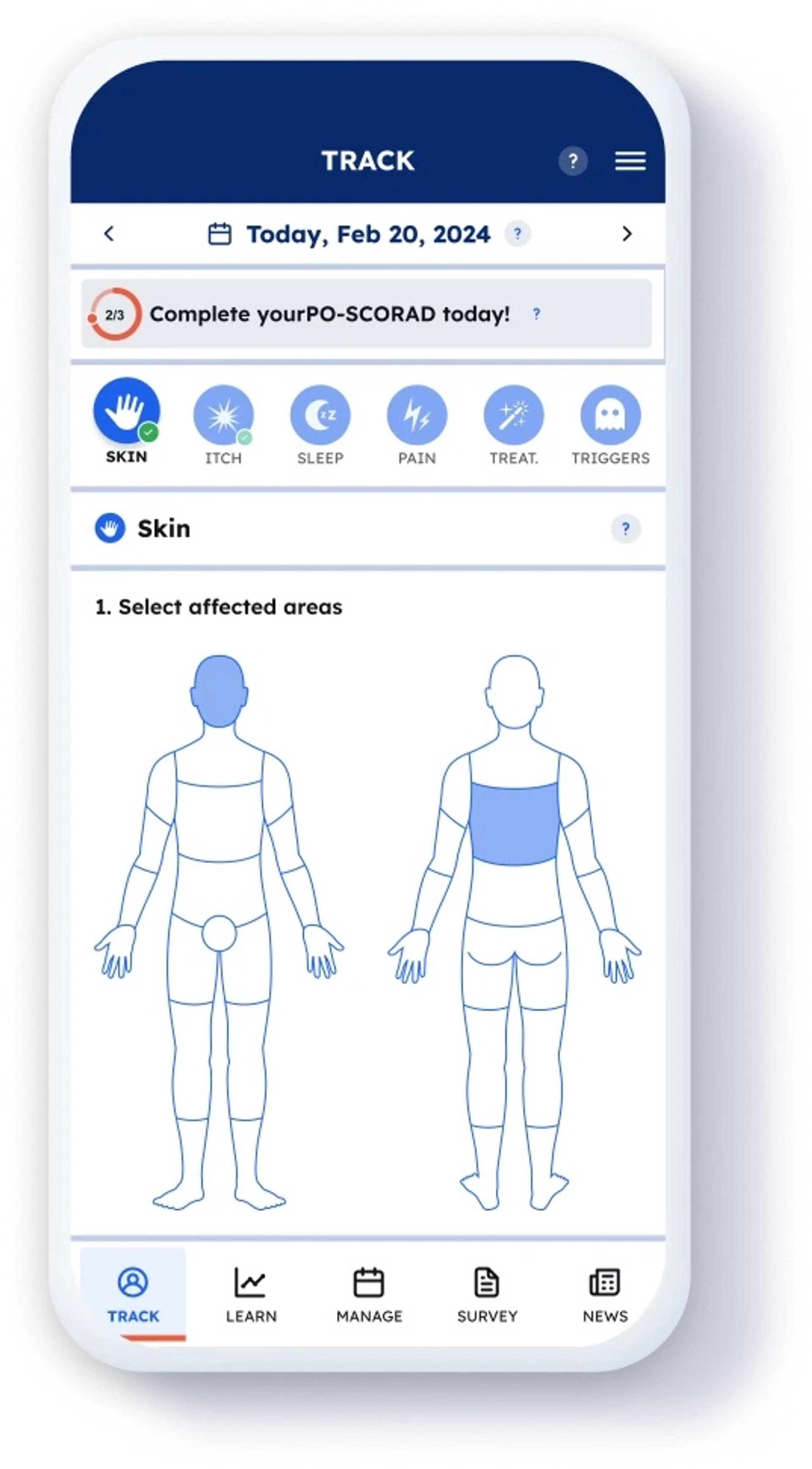 Alternative Ansätze zur Behandlung chronischen Handekzems