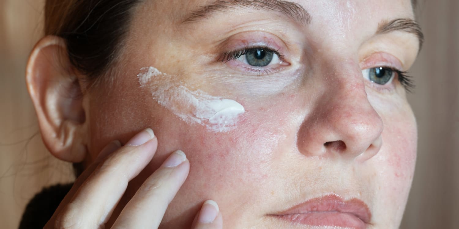 Fettige Haut: Wie mattiert man sie mit Azelainsäure?