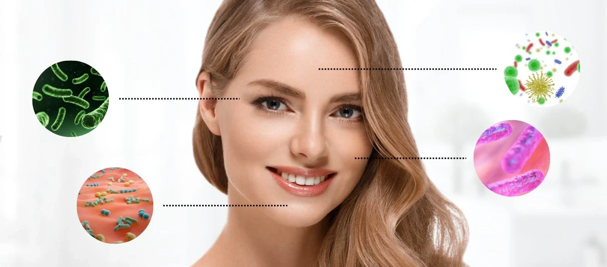 Vorteile von Probiotika zur Behandlung von Rosazea