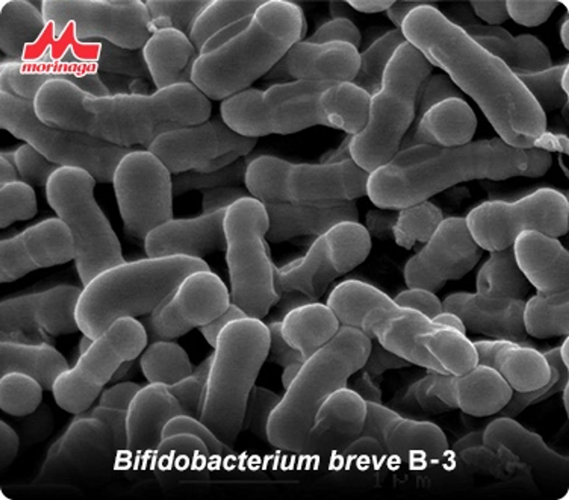 Vorteile von Probiotika zur Behandlung von Rosazea