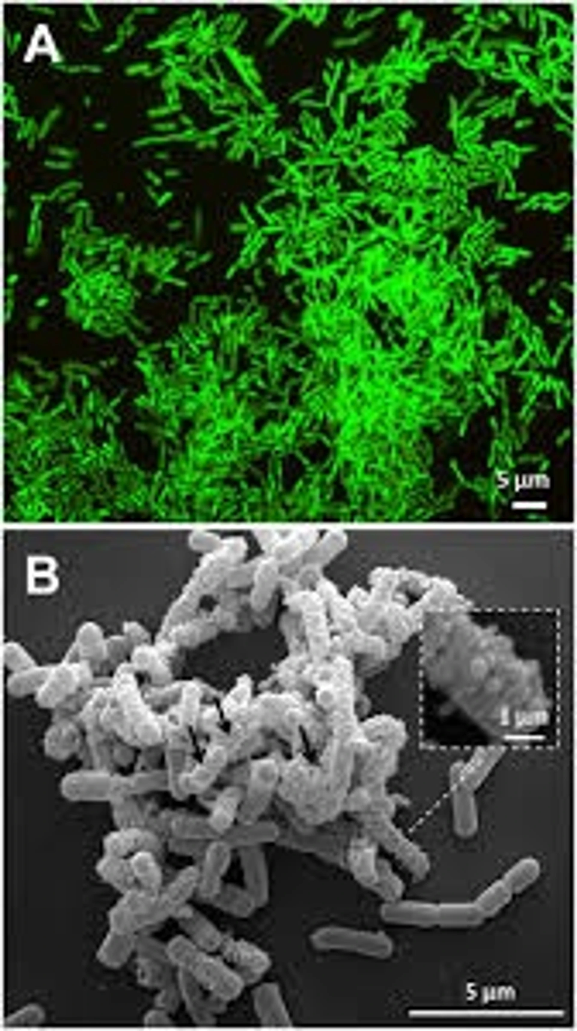 Vorteile von Probiotika zur Behandlung von Rosazea