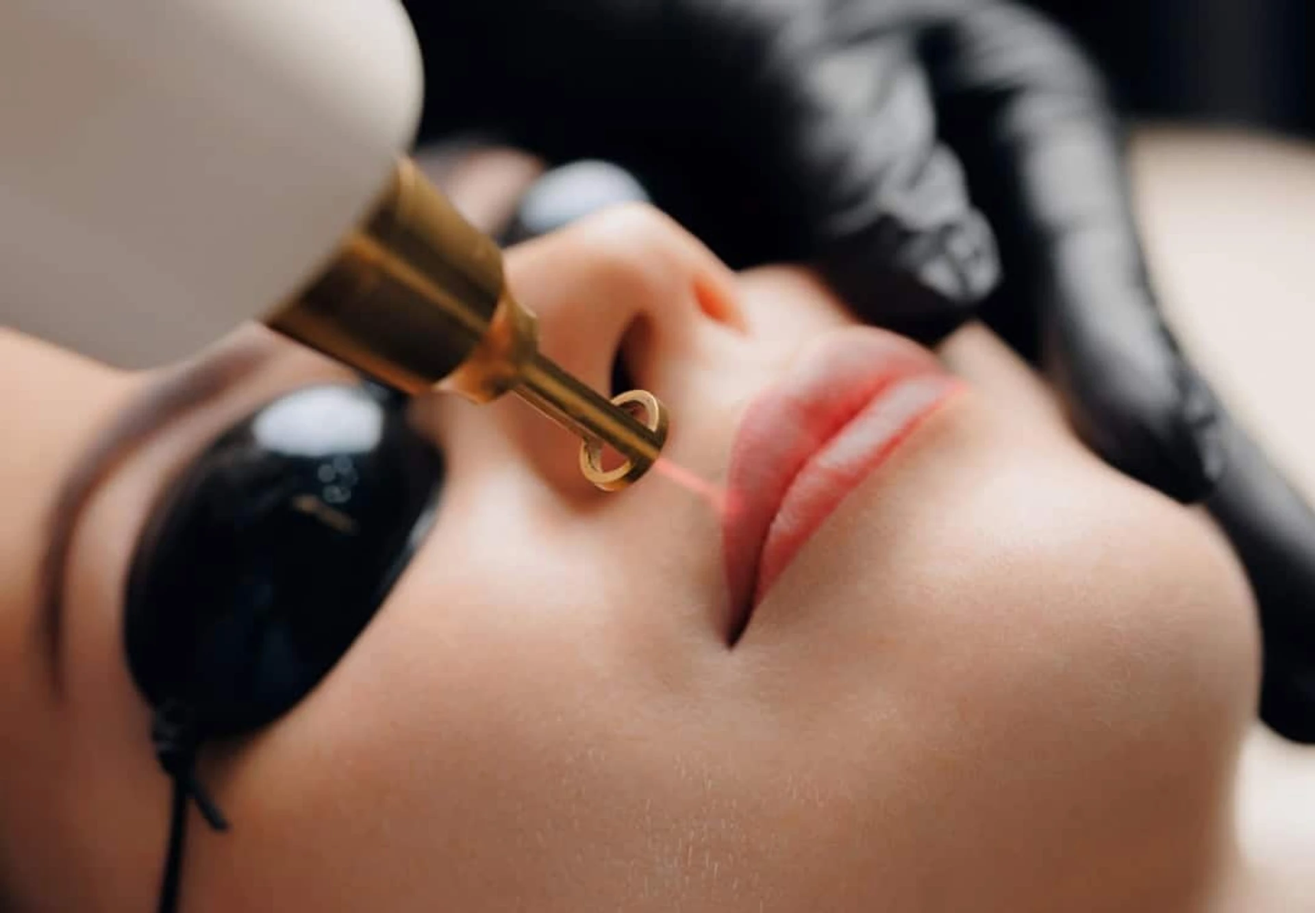 Ursachen der Lippenhyperpigmentierung und Behandlung dunkler Lippen