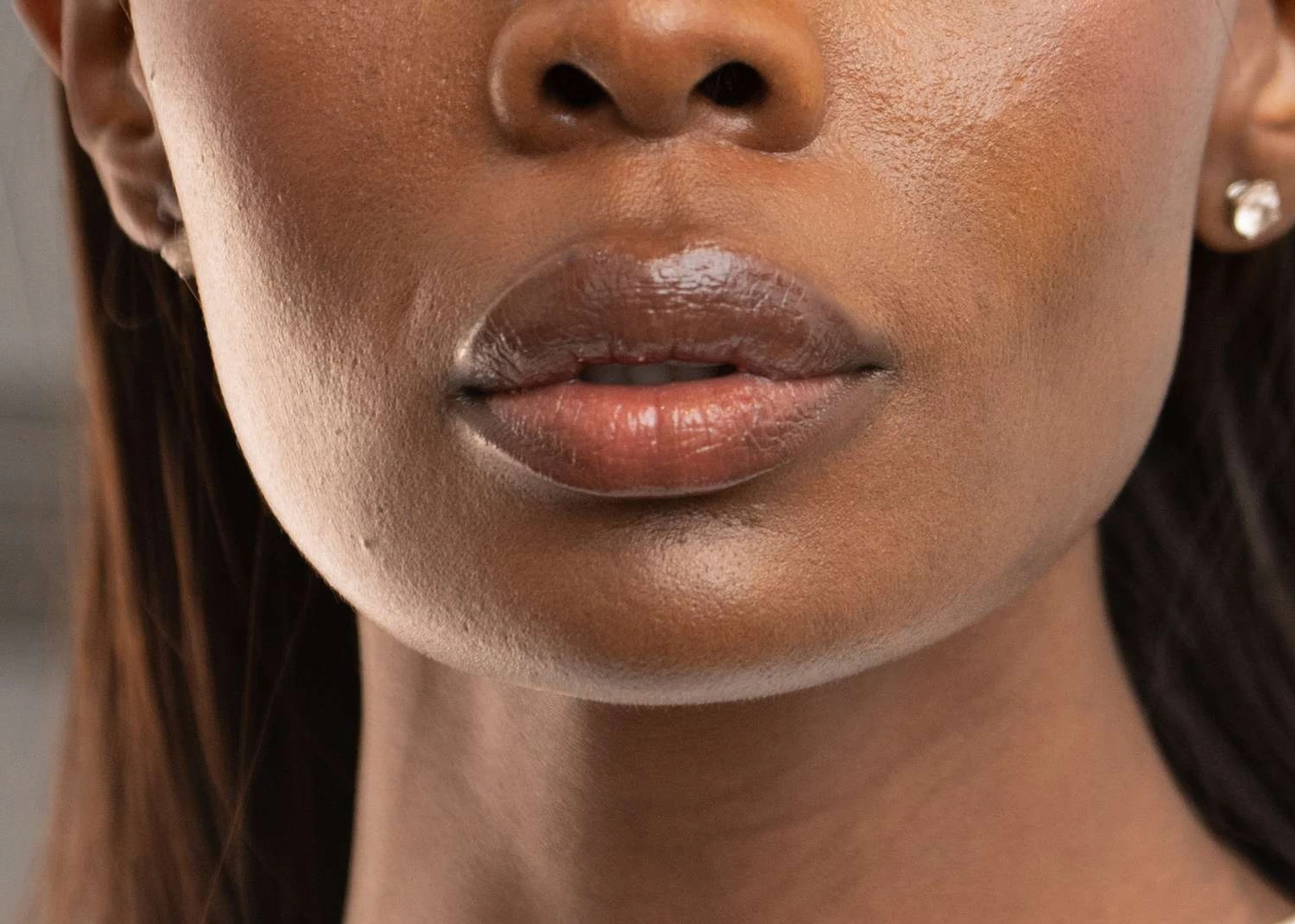 Ursachen der Lippenhyperpigmentierung und Behandlung dunkler Lippen